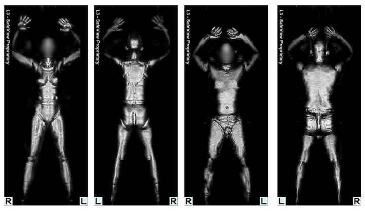 body scanner