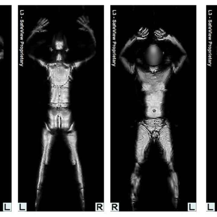 body scanner